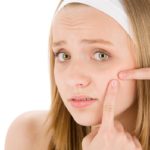 Come combattere acne: migliori rimedi brufoli efficaci