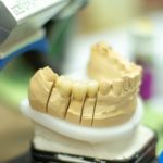 Laboratorio odontotecnico a Roma: come sceglierlo